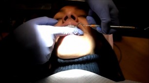 LadyLuXXX Braces Change